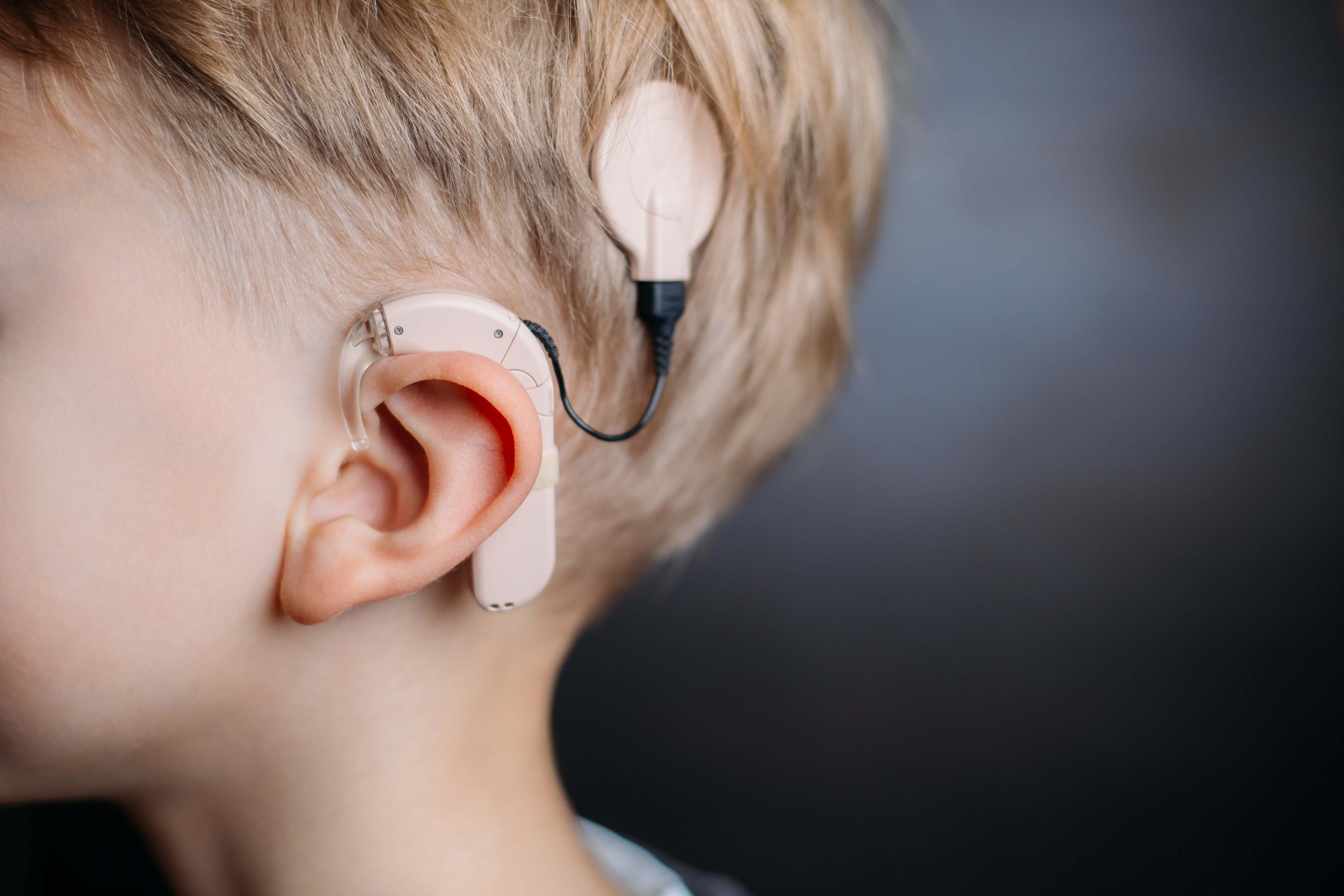 Cochlear Implant Recall